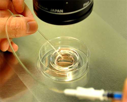 试管助孕服务与费用解析：包生男孩的医院选择与价格