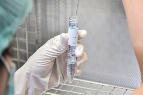 试管婴儿促排卵长短方案选择与助孕成功解析