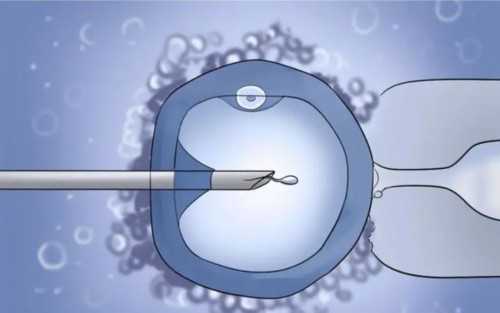 2026重庆供卵代怀费用与精子库医院指南,附助孕成功率解析
