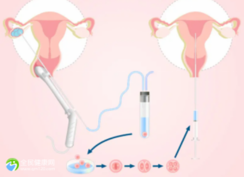 二胎政策补贴优惠及最新消息2026