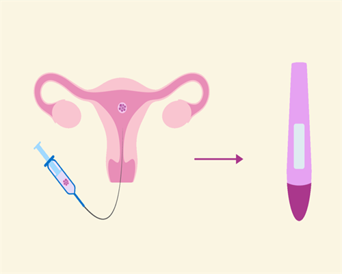 供卵试管生双胞胎与辅助生殖选择指南