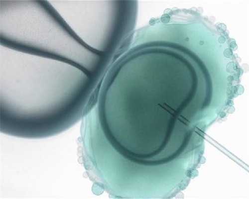 重庆试管婴儿费用解析与代生助孕指南