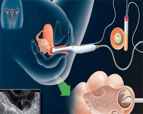 重庆私立试管婴儿医院排名及费用指南：代生助孕选择与医保政策解析